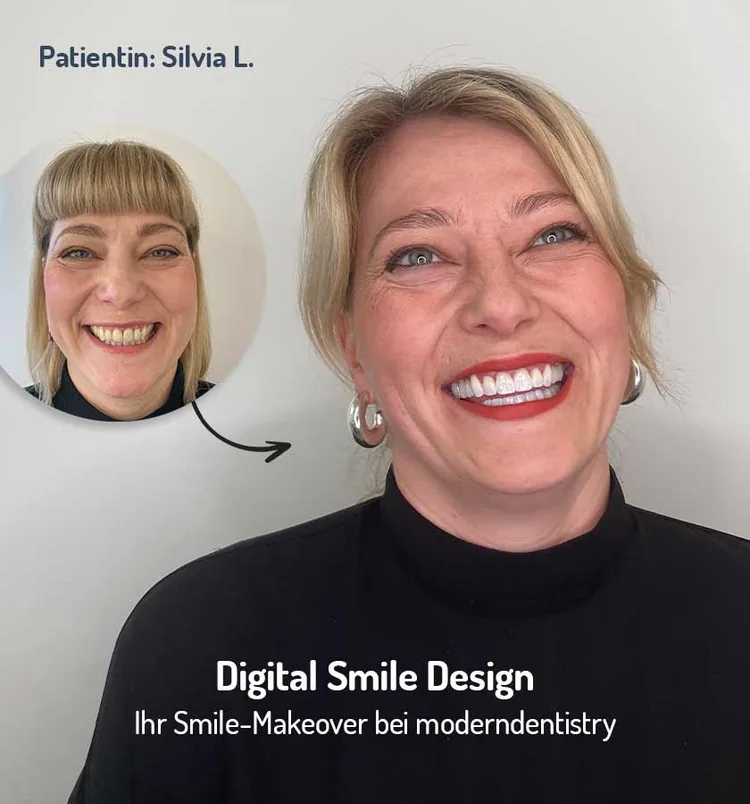 Frau lächelt nach einer Digital-Smile-Design-Behandlung in Leipzig