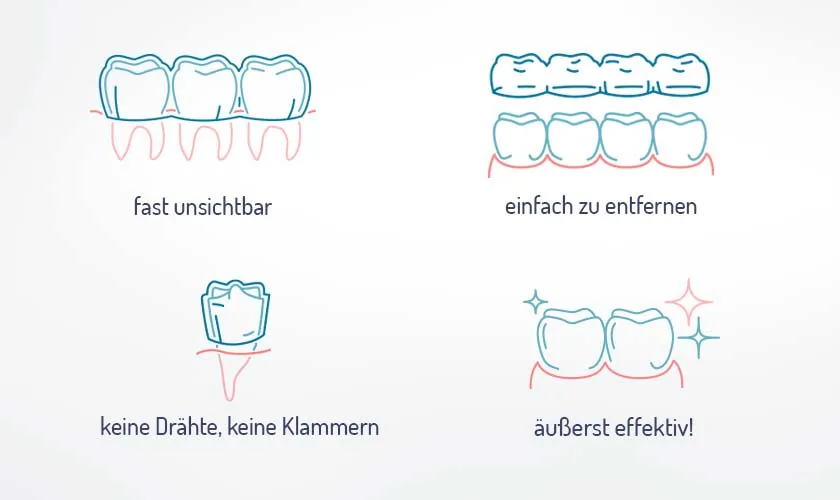 Infografik: Ablauf einer Aligner-Behandlung Schritt für Schritt